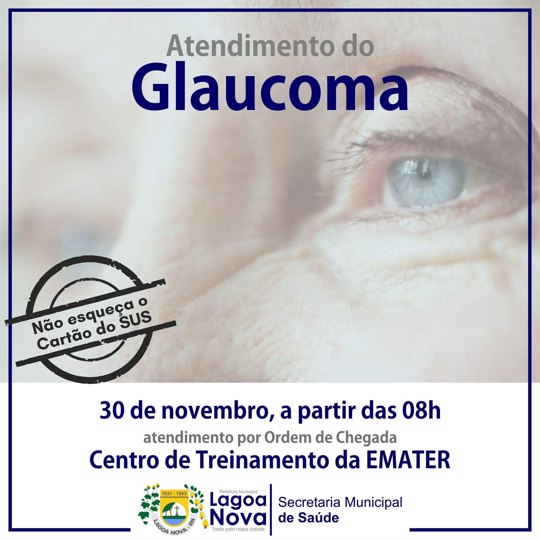ATENDIMENTO DO GLAUCOMA